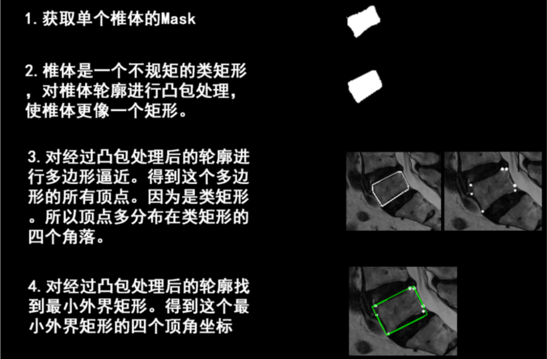人工智能医疗项目流程