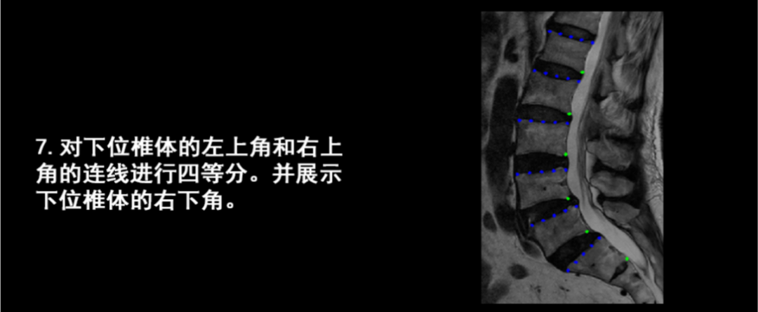 人工智能医疗项目流程详情椎体