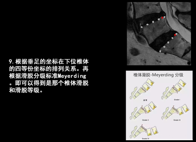 人工智能医疗项目流程详情脱落等级